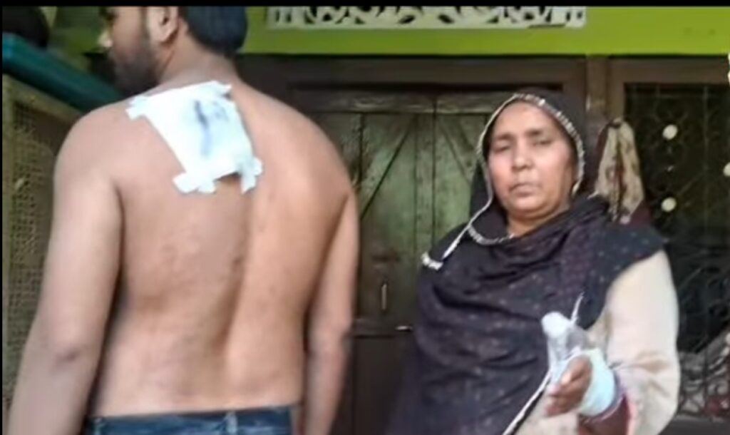 हिंडौन सिटी के बिजली खा का चौक निवासी युवक को पत्नी ने चाकू मारकर किया घायल