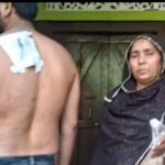 हिंडौन सिटी के बिजली खा का चौक निवासी युवक को पत्नी ने चाकू मारकर किया घायल